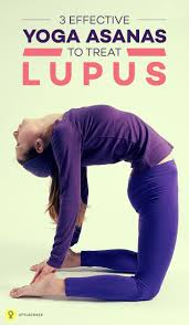 3 Effective Yoga Asanas To Treat Lupus Yoga Asanas Lupus Best Yoga