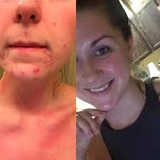 Beautiful Skin by Britt