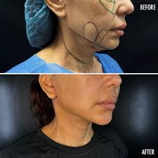 𝐃𝐑 𝐍𝐎𝐑𝐀 𝐒𝐓𝐀𝐍𝐅𝐎𝐑𝐃 𝐏𝐥𝐚𝐬𝐭𝐢𝐜 S𝐮𝐫𝐠𝐞𝐨𝐧