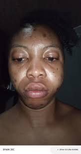 Greetings to you all in the house.... Please help me my teeth is paining  alot and has a whole in it, it's really rotten... Please help me with a  medicine that can