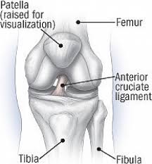 A ligament is a band of strong tissue in a person's body which connects bones. Acl Anterior Cruciate Ligament Injuries Harvard Health