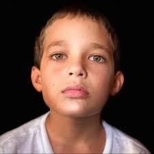 At just 13 years old, Keliʻi Lovell began experiencing weeks of constant  headaches and exhaustion. Concerned, his parents took him to the emergency  room, where doctors made a devastating discovery — an