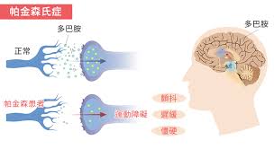 The site owner hides the web page description. å·´é‡'æ£®æ°ç—‡æ€Žä¹ˆæ²» 1ç¢—è'¸è›‹è¡¥è‚¾æ´»è„'æŠ—é€€åŒ– å¸•é‡'æ£®æ°ç—‡ ä¸­åŒ» è¯è†³ å¤§çºªå…ƒ