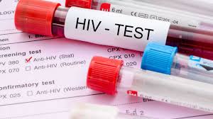 Image result for hiv aids