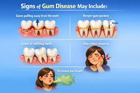Gum Disease vs Gingivitis: What's the Difference?