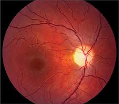 Lighting fixtures to illuminate the lower levels and highlight the entrances. Use Of The Hand Held Ophthalmoscope Basicmedical Key