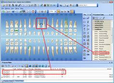 55 Best Clinical Charting Images Dental Charting Dental