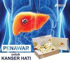 Nurul asyikin berkata, anaknya sebelum ini sudah disahkan bebas daripada kanser hati tahap dua pada 2017, namun tahun lalu dia tidak menyangka perubahan pada anaknya yang sering mengadu sakit di. Ubat Kanser Hati Tahap 4 Pertanyaan A