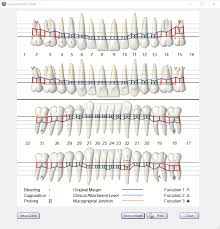 Open Dental Software Graphical Perio Chart