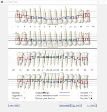 open dental software graphical perio chart