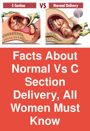 Facts About Normal Vs C Section Delivery All Women Must Know Human Birth Is Truly A Miracle And There Are Tw Exercise For Pregnant Women Birth Facts C Section