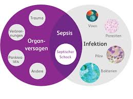 Evaluation and management of suspected sepsis and septic shock in adults. Sepsis Management