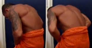 Résultat de recherche d'images pour "penis degloved"