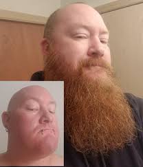 Day 1 vs exactly 1 year. The Norwegian is strong in me? : r/beards