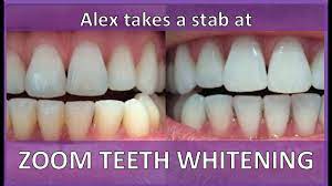 If you decide it costs too much to get your teeth whitened another professional teeth whitening service is zoom whitening. Zoom Teeth Whitening Honest Review Youtube