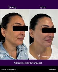 There any many times when a women may choose to refresh her appearance:  before a big day, after a life changing event or simply because she feels  like it!⁠ ⁠ ⁠ Are