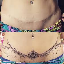 Tattoos fall into three broad categories: C Section Cover Up Tattoos