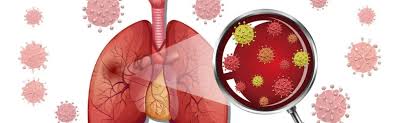 Image result for Pneumonia