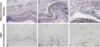 In a motor unit the motor neuron branches to form neuromuscular. Histology And Smooth Muscle Actin Sma Immunohistochemistry Of Levator Download Scientific Diagram