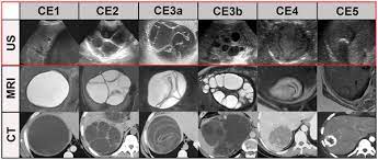 Check spelling or type a new query. Gharbi Classification Medical Imaging Mri Ultrasound
