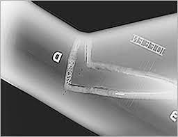 Pin On Ndt Rt With Digtal Radiography