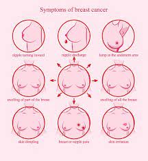 Only a doctor can tell if symptoms are caused by cancer or some other problem. Breast Cancer Organisation India Turns Pink Breast Caner Awareness Breast Cancer Organisation Breast Cancer Awareness Foundation Breast Cancer Ngo Breast Cancer Awareness In India Breast Cancer Awareness In Chennai