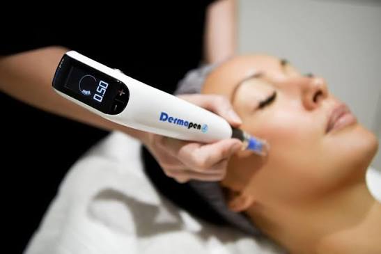 Dermapen4™ Microneedling