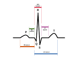 Electrocardiogram Wikilectures