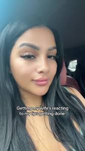 Fabi Teeth Before and After