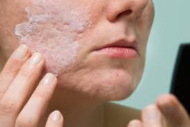 La Pomada De La Campana Para Aclarar Manchas Y Cicatrices, Anti-Arrugas,  Etc. | Mariebelle Cosmetics - Youtube