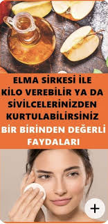 Elma Sirkesi Sivilceye Iyi Gelir Mi Elma Sirkesi Elmalar Dogal