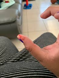 To prevent ingrown armpit hairs, try using a shaving gel instead of shaving foam, which can cause underarm dryness that leads to irritation and ingrown hairs. I Have An Ingrown Hair In My Armpit And It Swelled So Bas I Stabbed It And This Came Out Popping