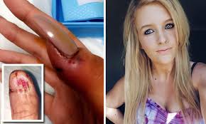 However, this time she ripped her acrylics off as. Woman 27 Left In Excruciating Pain After Botched Fake Nail Treatment In Sydney Salon Daily Mail Online