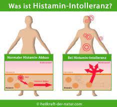Histaminunvertraglichkeit Histaminintoleranz Symptome Ursachen Behandlung Heilkraft Der Natur