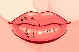 Akan tetapi cara tersebut tetap saja kurang memuaskan karena hanya bersifat sementara. 8 Tanda Kesehatan Bisa Dilihat Dari Kondisi Bibir Salah Satunya Bibir Pecah Pecah Yuk Jangan Dibiarkan Saja Semua Halaman Intisari