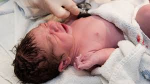 Jack morrow who assisted the woman through the whole operation. After Baby Is Born What To Expect Raising Children Network