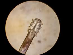 Image result for Demodex folliculorum