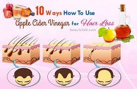Here is how to get rid of dandruff using acv based of your scalp type. Top 10 Ways How To Use Apple Cider Vinegar For Hair Loss Cure