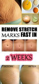 Add some drops of almond oil and lemon juice in it. Pin On All Natural