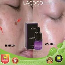 Cara alami menghilangkan bekas jerawat. Jual Lacoco Anti Flek Penghilang Bekas Jerawat Paling Ampuh Terbaru Juni 2021 Blibli