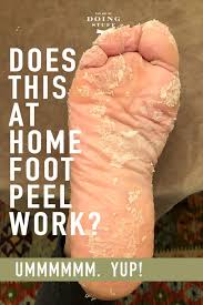 People and animals are acceptable; How All The Skin Peeled Off Of My Feet Home Pedicure Review The Art Of Doing Stuff