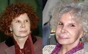 Plastic surgery procedures started as medical treatments but grew into cosmetic surgeries. 17 Celebrity Before And After Plastic Surgery Disasters