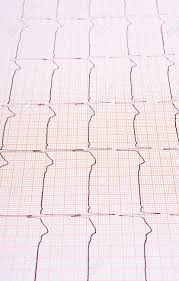 Heart Rhythm Chart For Background Usage