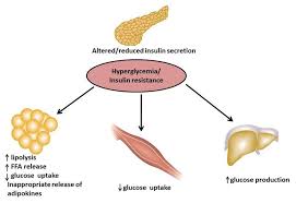 The growing epidemic of obesity in children is in fact, many people with type 2 diabetes are unaware that they have it. Pathophysiology Of Type 2 Diabetes Mellitus T2dm Download Scientific Diagram