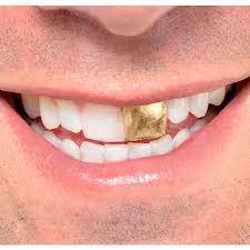 These dental gold remains are compounded of 86% pure gold and silver. Gold Tooth Party City