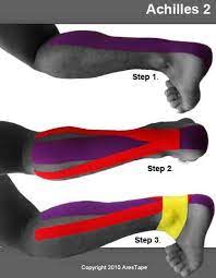Kt Tape Achilles Tendonitis Google Search Achilles Tendonitis Kinesiology Taping Kt Tape