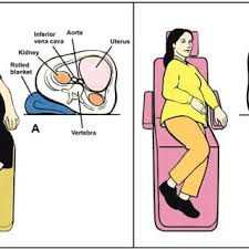 Schematic Presentation Of Correct Dental Chair Positioning For Pregnant Download Scientific Diagram