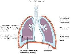 Image result for Intrapleural Anesthesia