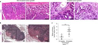 In the united states, one in 20 people is at a risk of developing colorectal cancer in their lifetime. Inducible Mouse Models Of Colon Cancer For The Analysis Of Sporadic And Inflammation Driven Tumor Progression And Lymph Node Metastasis Nature Protocols