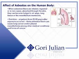Maybe you would like to learn more about one of these? Asbestos Mesothelioma Cases Presented By Sara Salger On Behalf Of Gori Julian Associates P C Edwardsville Il Ppt Download